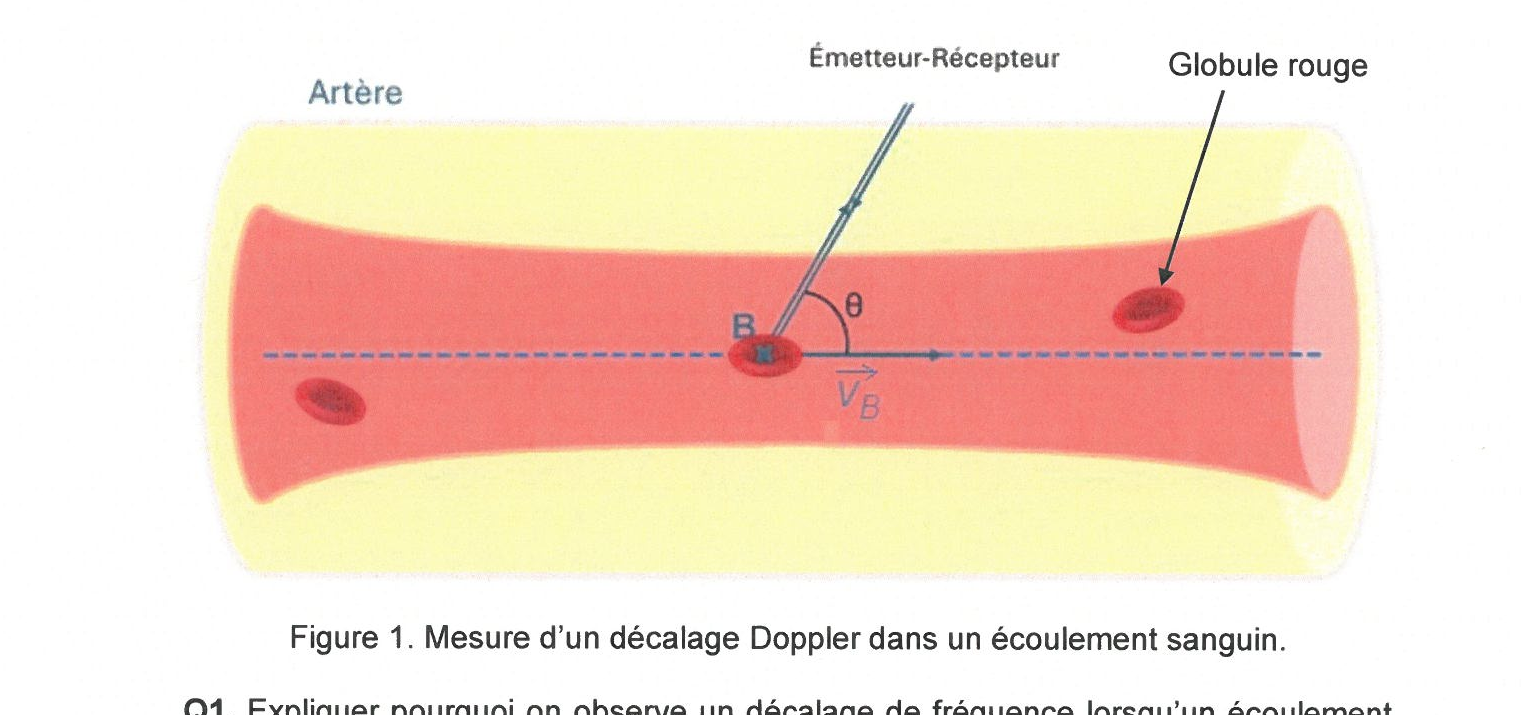 Figure du sujet